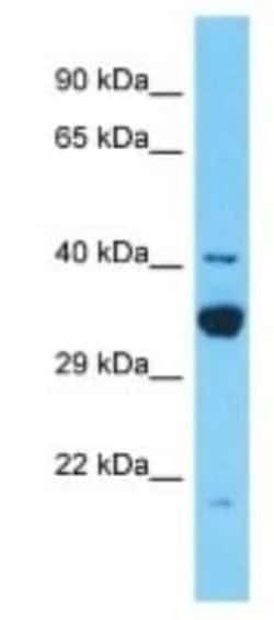 TDRD12 Rabbit anti-Human, Polyclonal, Novus Biologicals 100 &mu;g; Unconjugated:Antibodies,